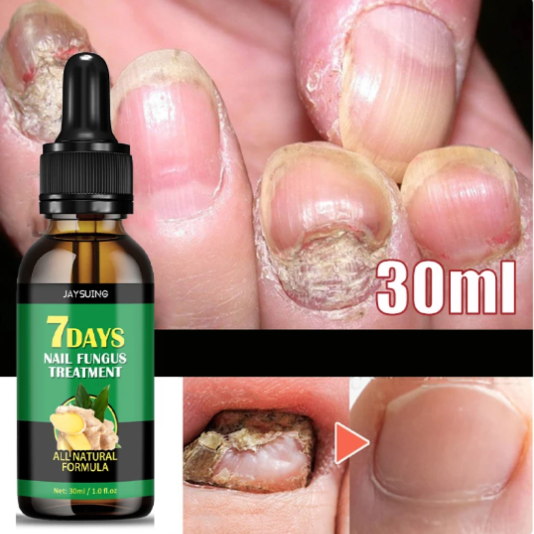 ACEITE DE JENGIBRE PARA UÑAS - 🧴 "¡Basta de esconder tus uñas! Limpieza profunda y fortalecimiento con jengibre"