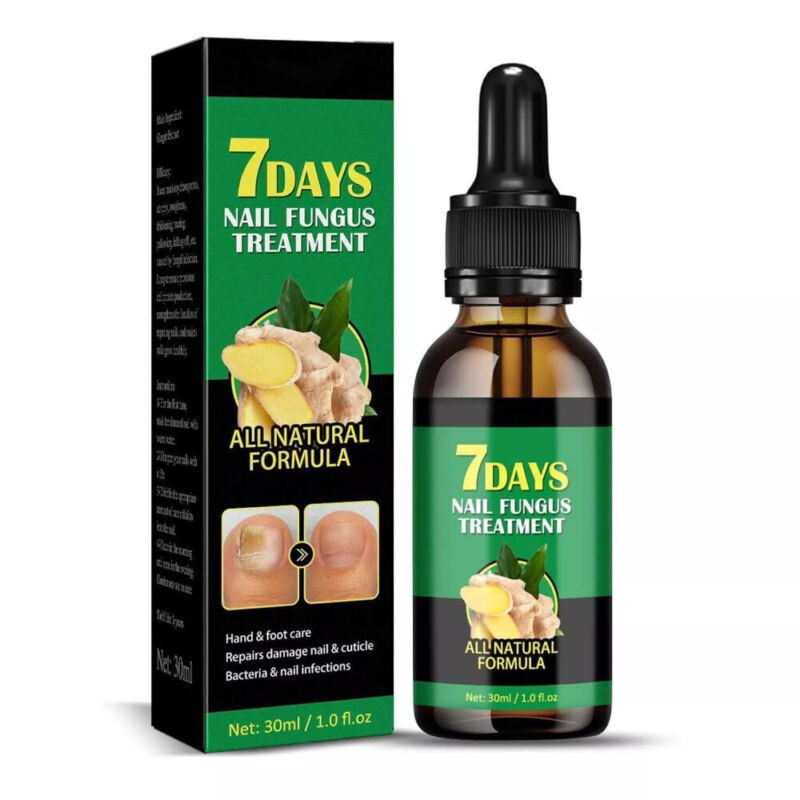 ACEITE DE JENGIBRE PARA UÑAS - 🧴 "¡Basta de esconder tus uñas! Limpieza profunda y fortalecimiento con jengibre"