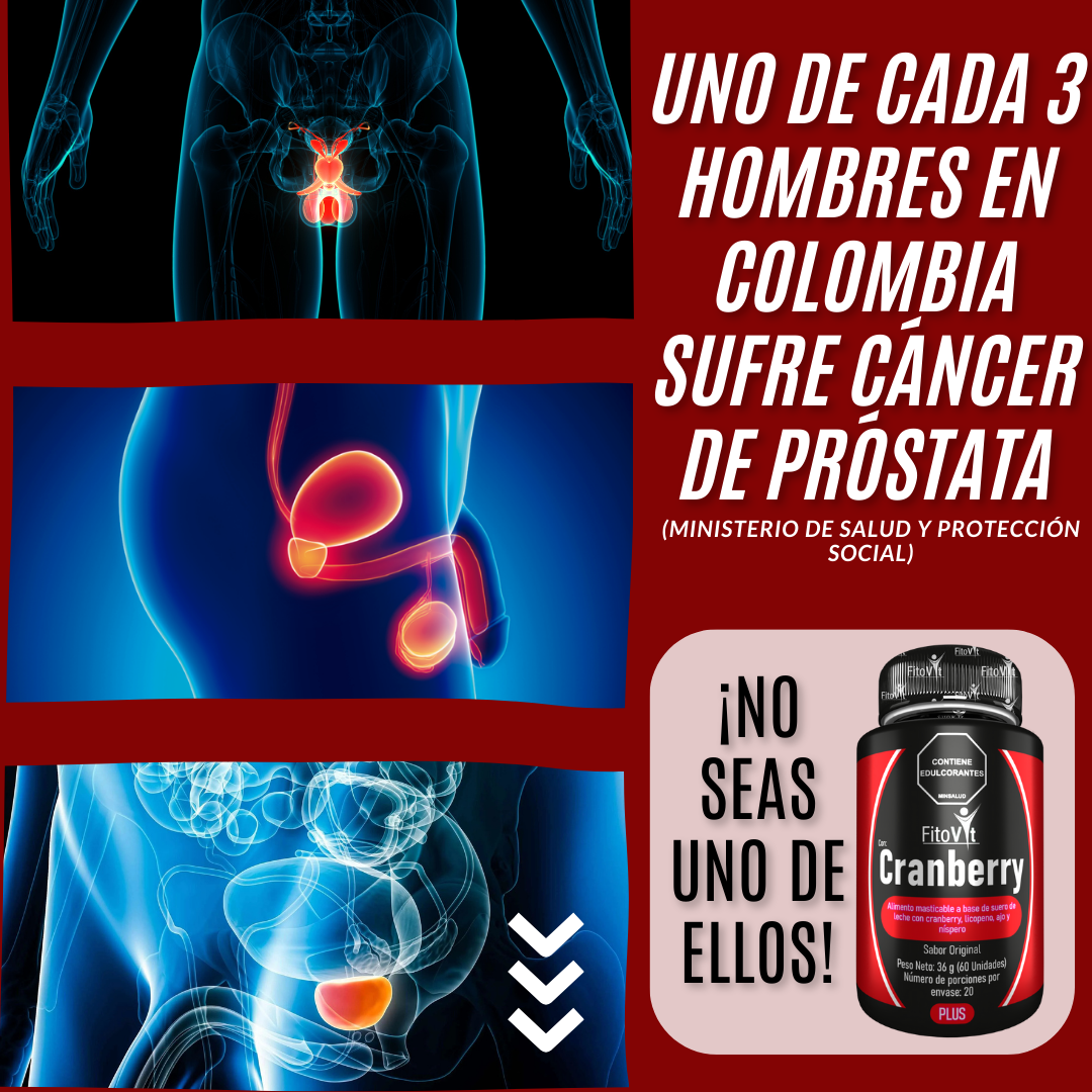 03 CRANBERRY TRATAMIENTO PARA LA PRÓSTATA